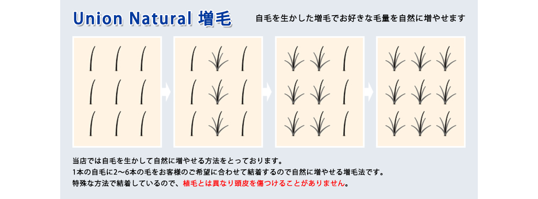 ユニオンナチュラル脱毛,自毛を生かした増毛イメージ