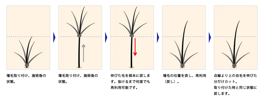 増毛メンテナンスイメージ